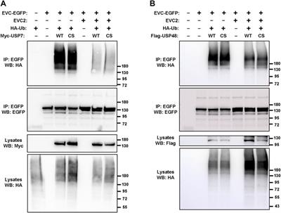 EVC-EVC2 complex stability and ciliary targeting are regulated by modification with ubiquitin and SUMO